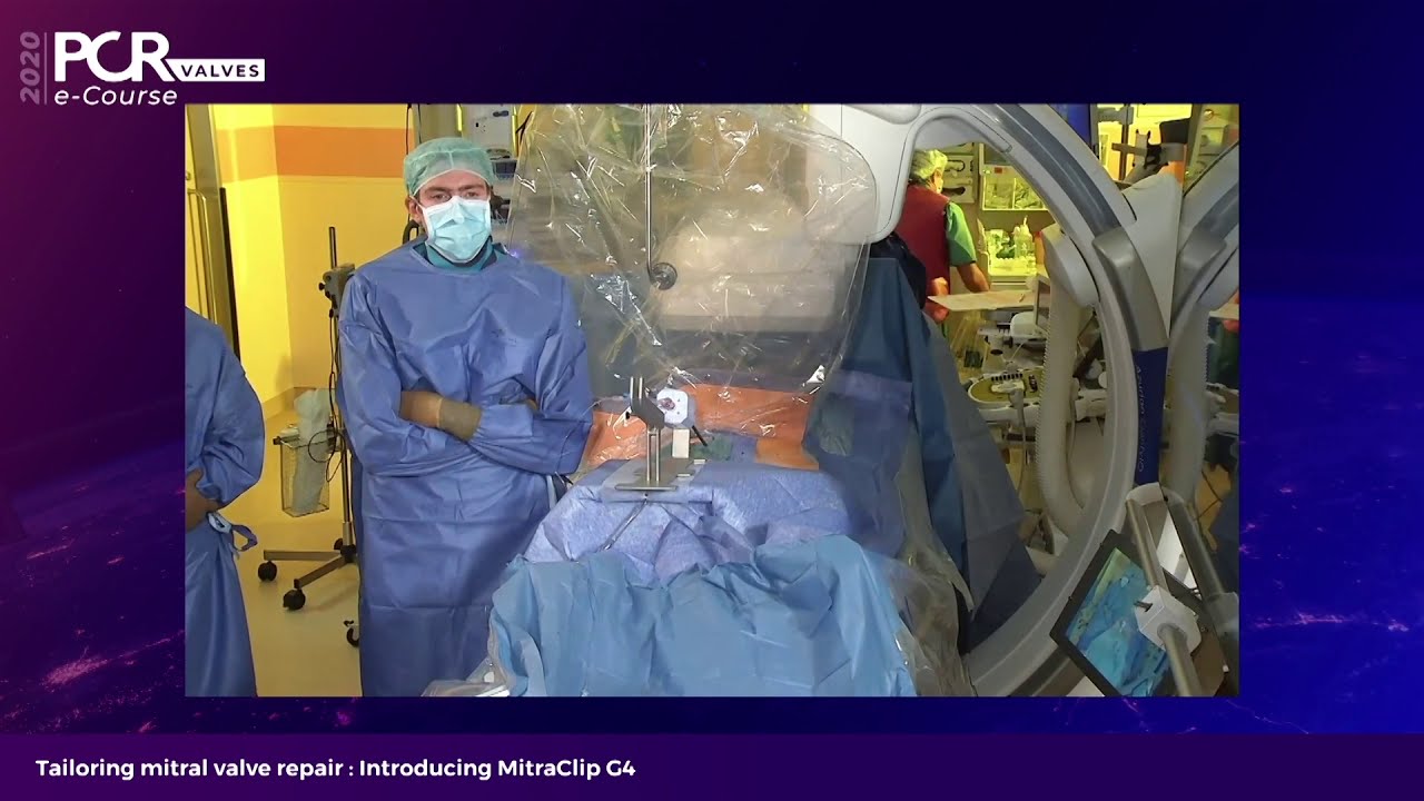 Tailoring mitral valve repair: Introducing MitraClip G4 - PCR Valves e-Course 2020
