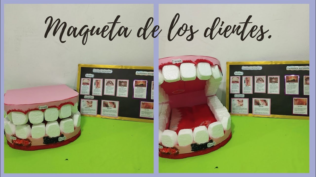 MAQUETA DE LA BOCA CON LESIONES EN TEJIDOS BLANDOS/ MAQUETA DE LOS DIENTES - KARLA MALPICA