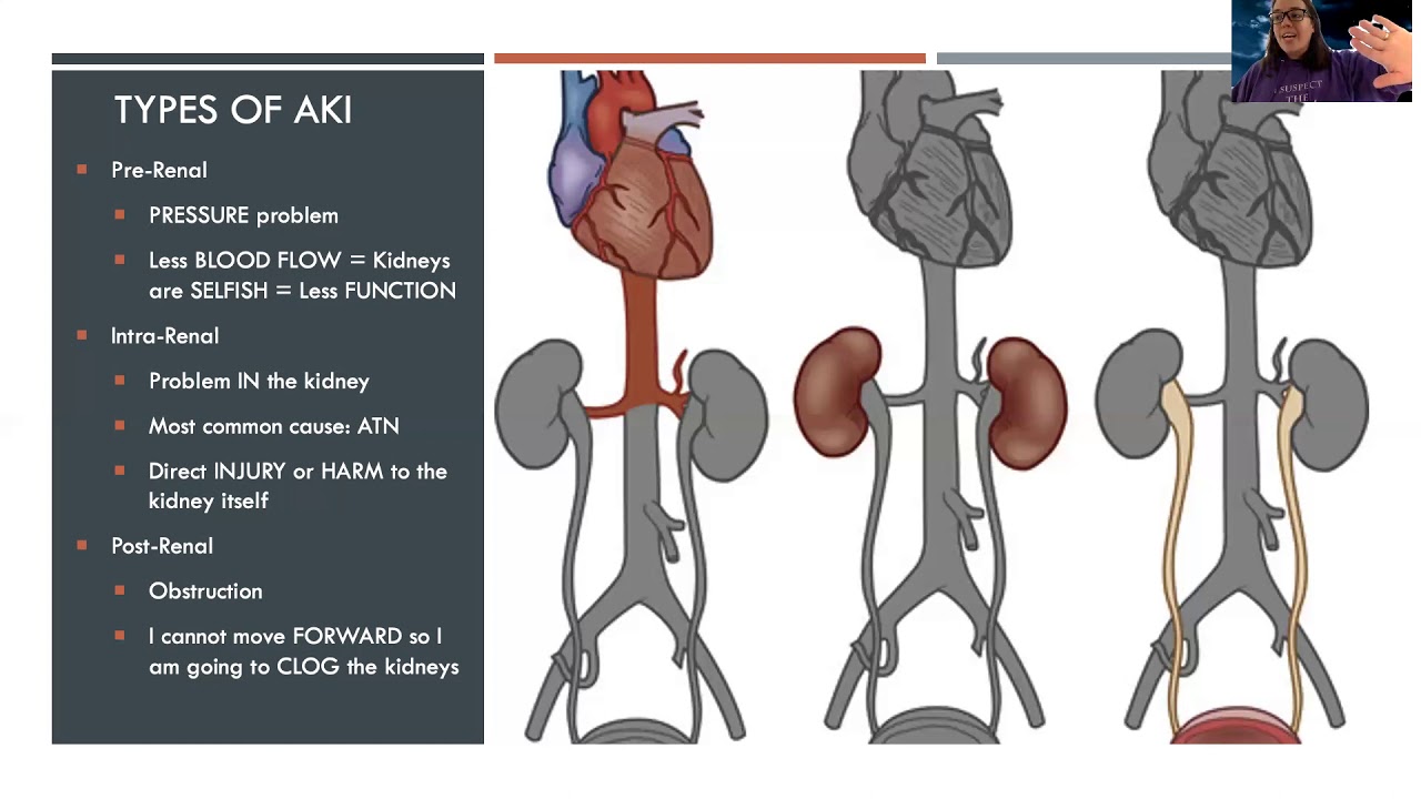 COMPLEX: AKI TYPES and PHASES