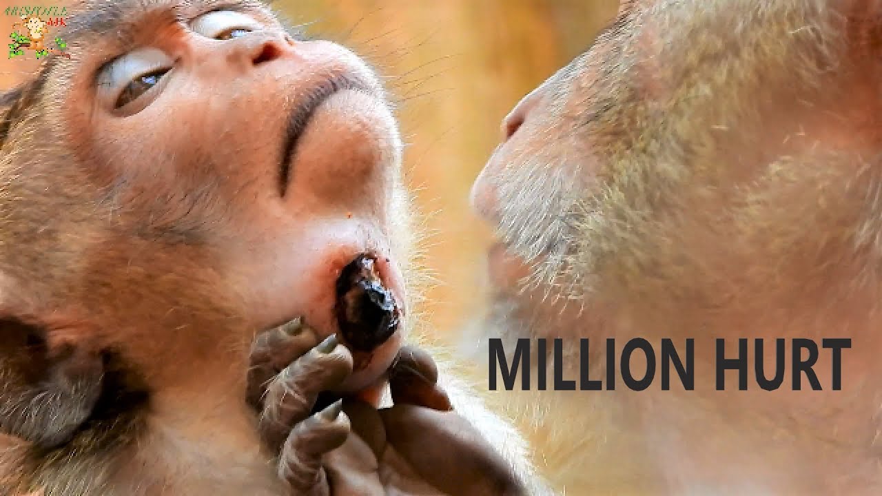 BILLION HURT... MILLION PITY SEEN SPRING STUCK ON NECK UNTIL LEAK NEARLY FOREIGN  BODY OUTSIDE |