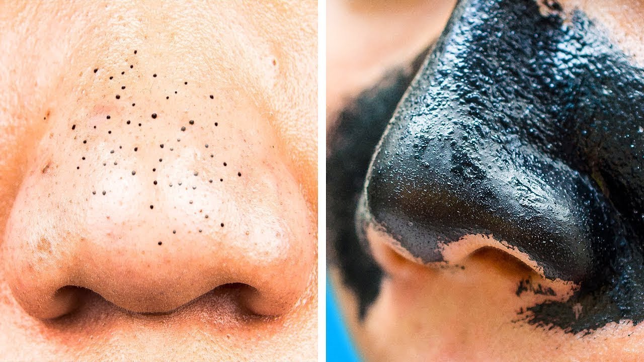 20 TRUCOS SIMPLES CON CARB&Oacute;N ACTIVADO QUE REALMENTE FUNCIONAN DE MARAVILLA
