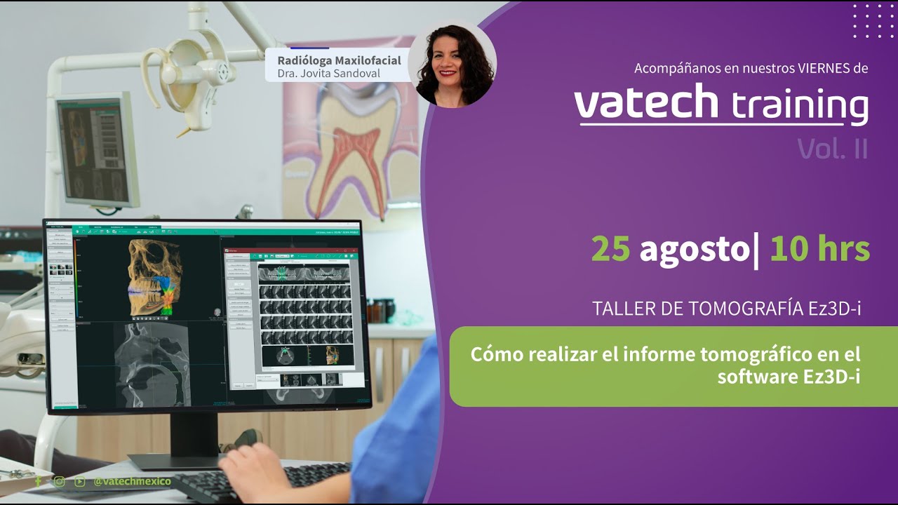 Vatech Training 8°: Cómo realizar el informe tomográfico en el software Ez3D-i #VatechTraining