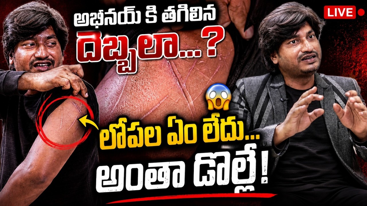 లైవ్&zwnj;లో దెబ్బలు చూపించిన అభినయ్ దర్శన్..!@SignatureStudiostv