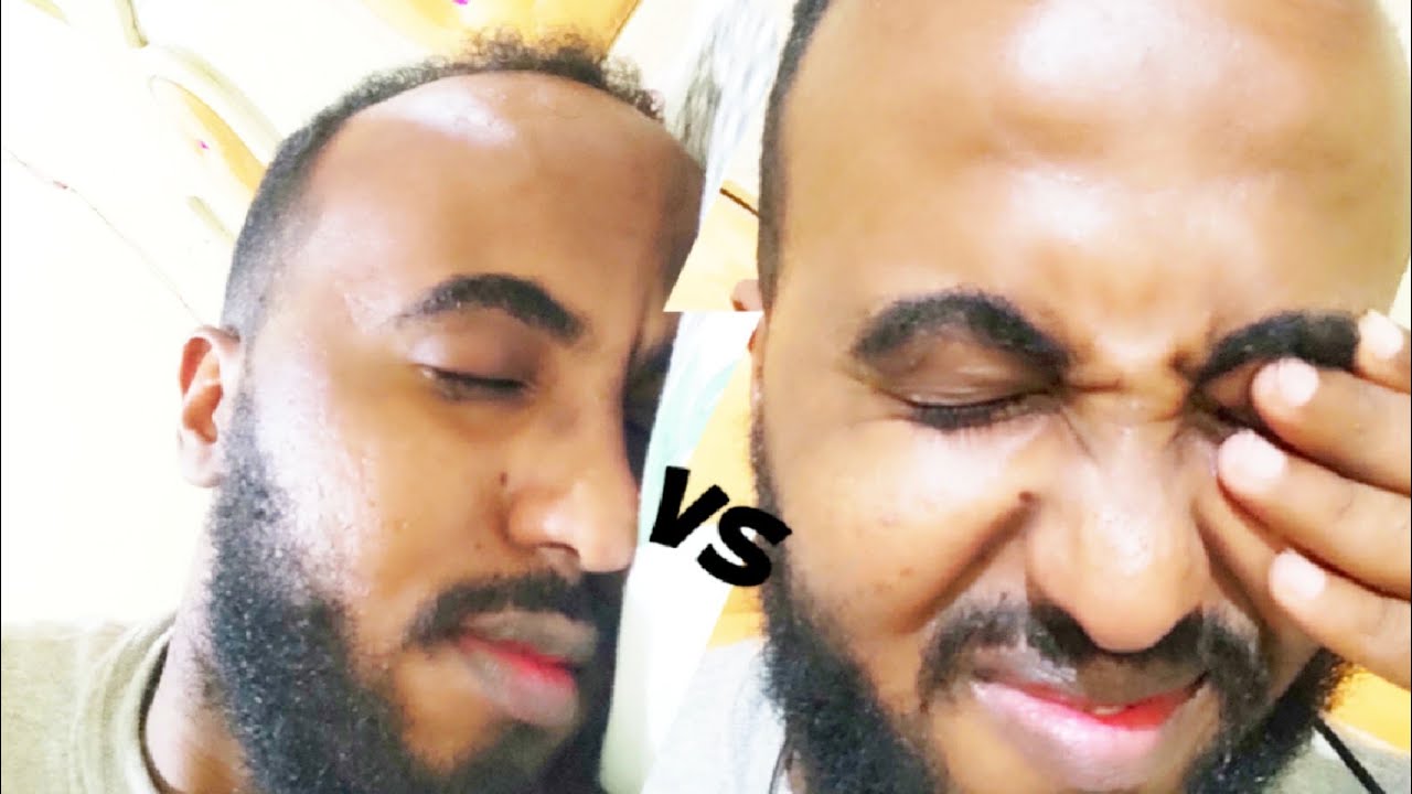 Hurdo La'aan maku heesaa kadib neh indhaha maku xanuunaan.