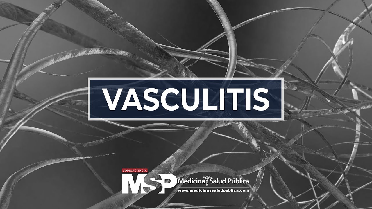 La vasculitis