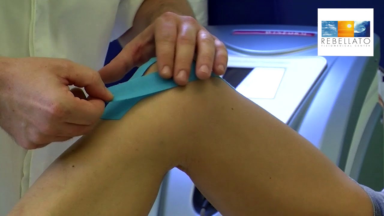Agire sull’infiammazione con il Kinesio Tape