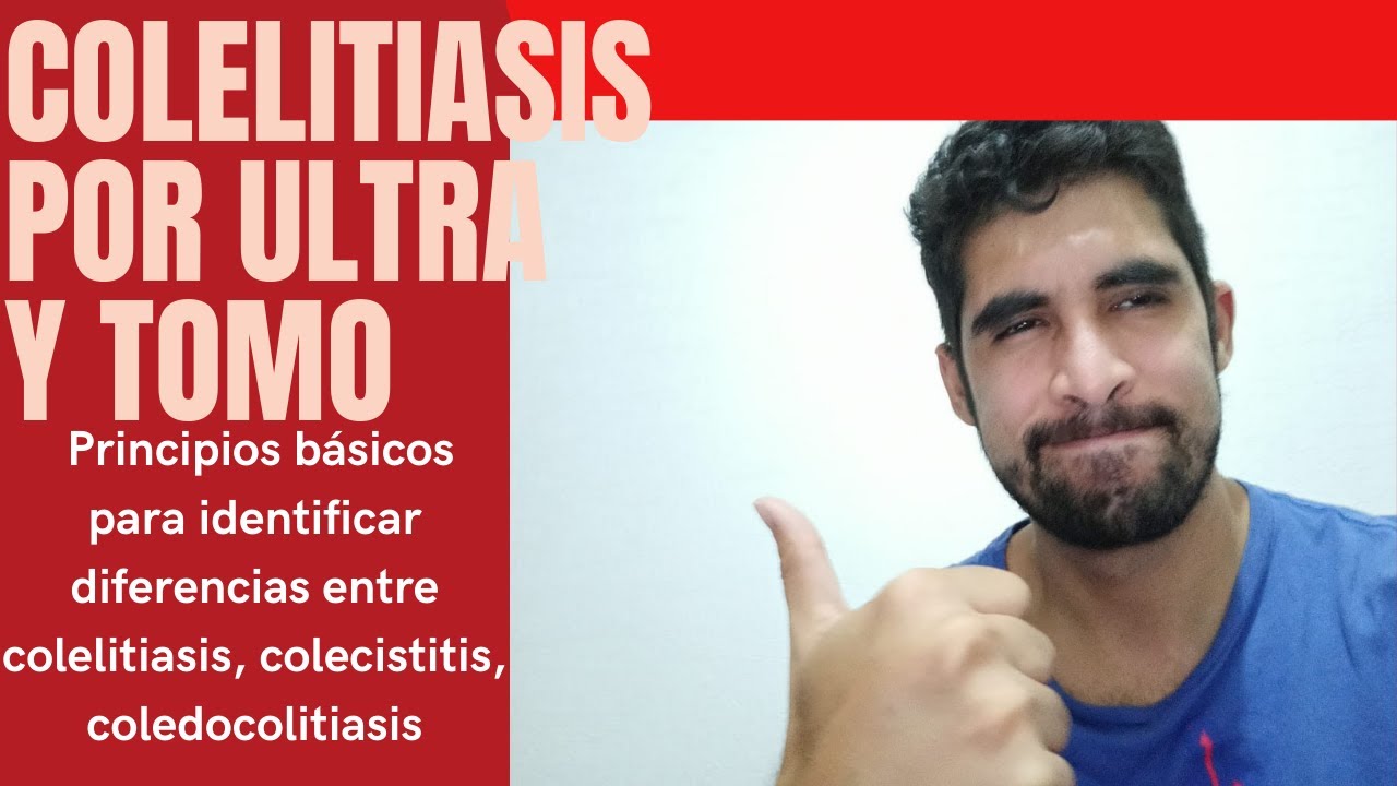 Colelitiasis y colecistitis, diferencias clínicas y por ultrasonido