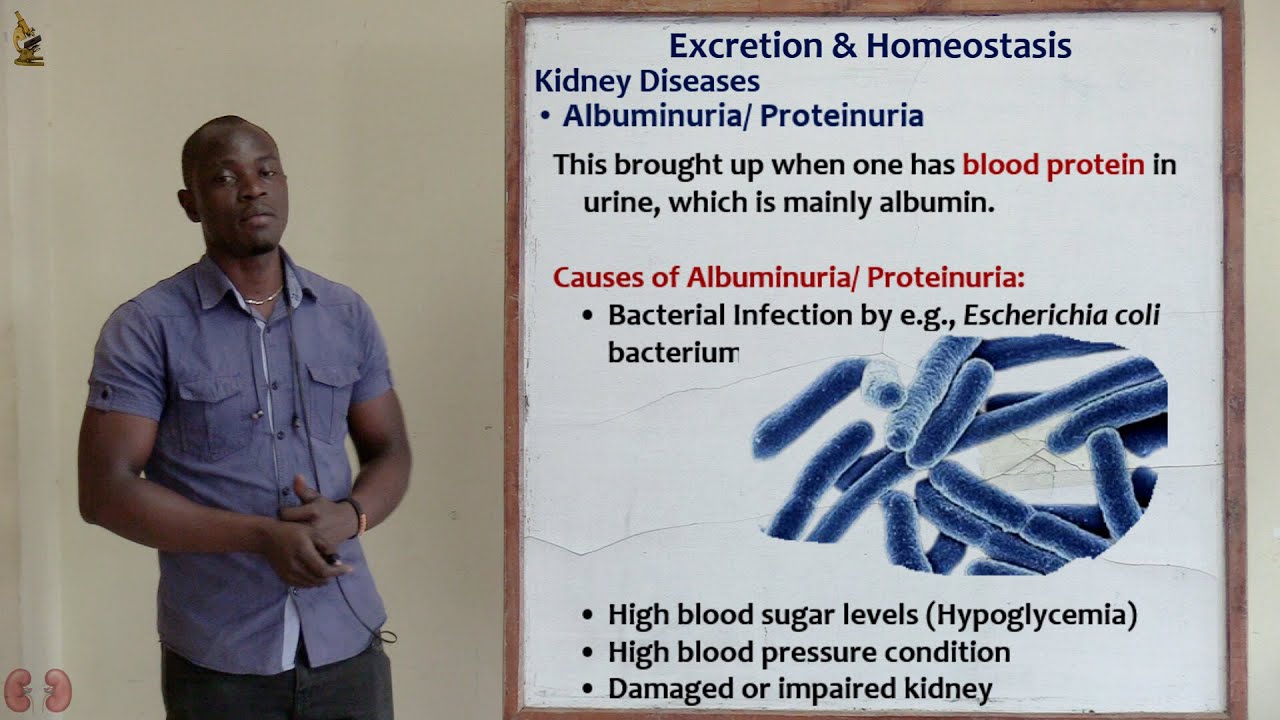 31. Kidney Diseases 2 Biology Form 2