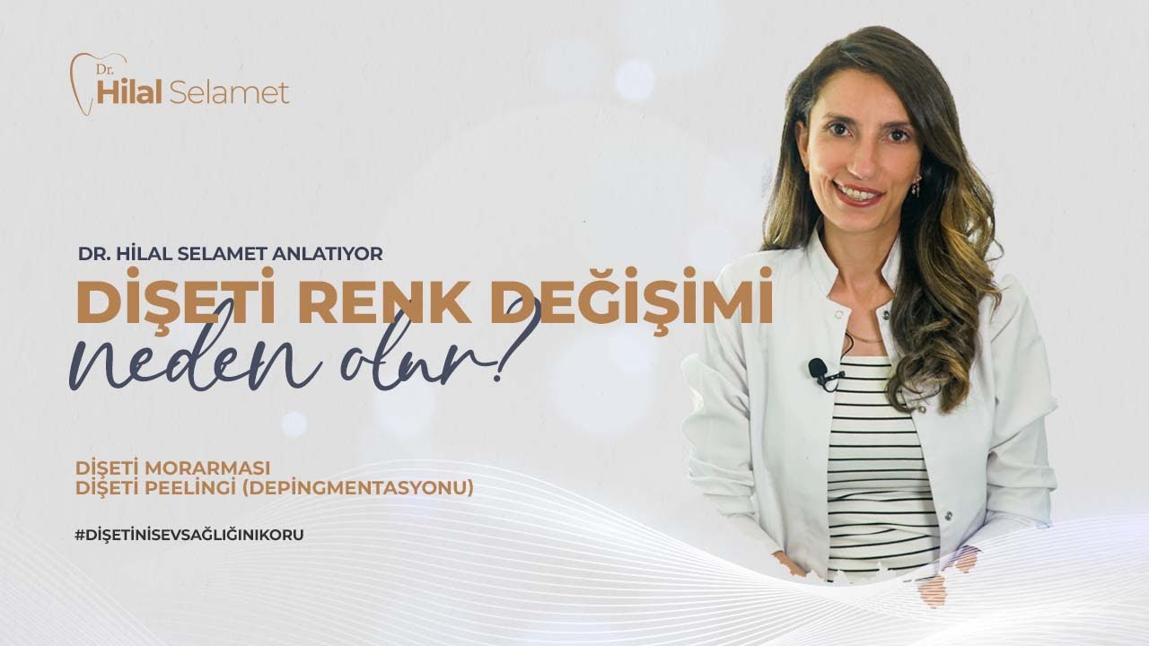 Diş eti Renk Değişimi Neden Olur? Dişeti Morarması I Dişeti Peelingi (Depigmentasyonu)