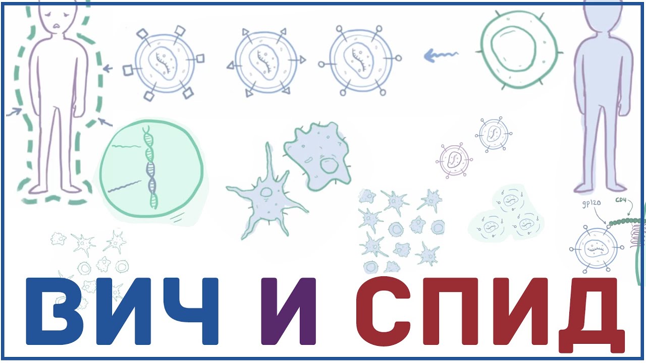 ВИЧ и СПИД - патогенез, причины признаки, симптомы, передача