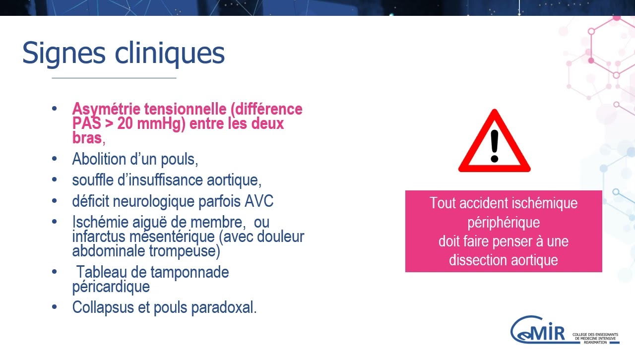 3 BONUS 1 Douleur thoracique aiguë