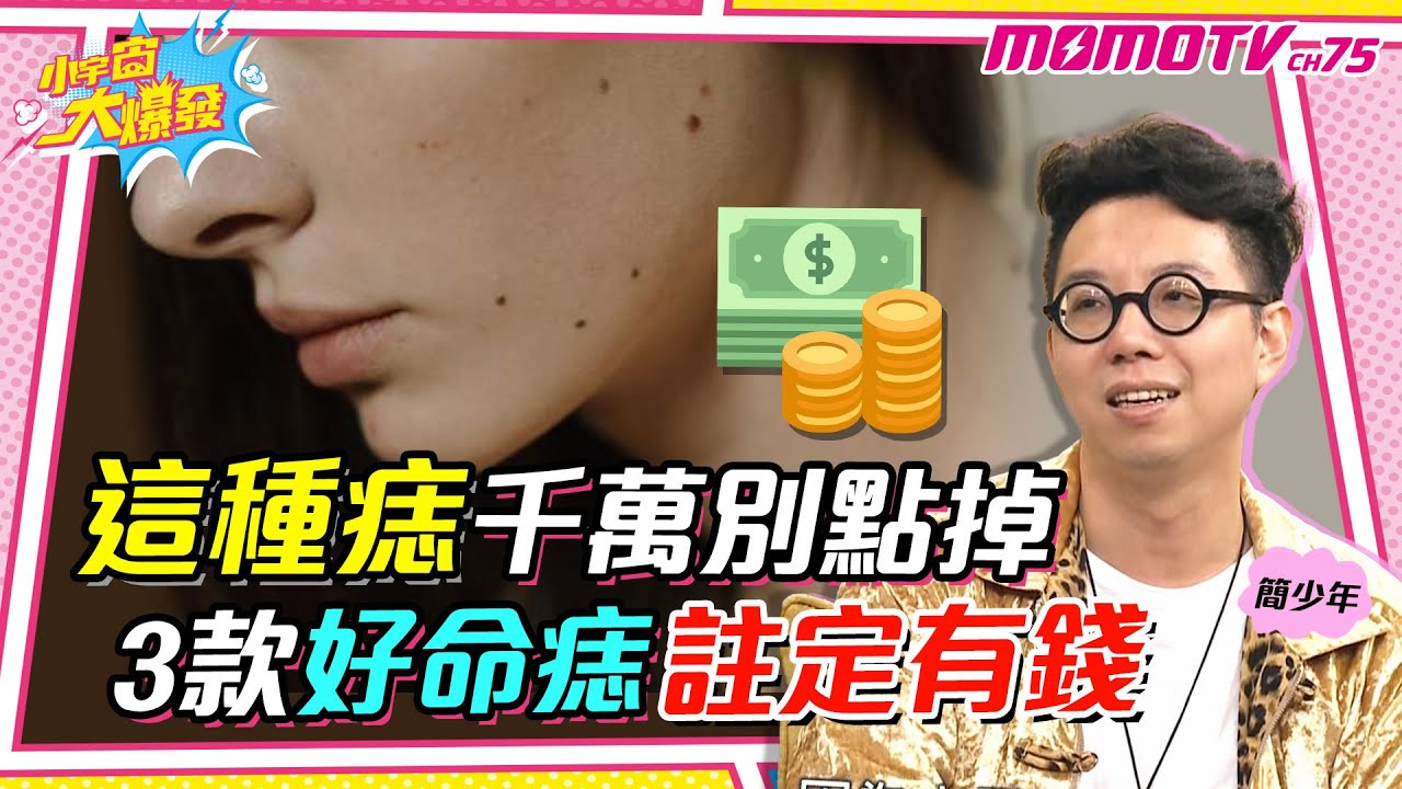 這種痣 千萬別點掉! 3款好命痣 註定有錢 ft.謝凱蒂 簡少年【 小宇宙大爆發 】