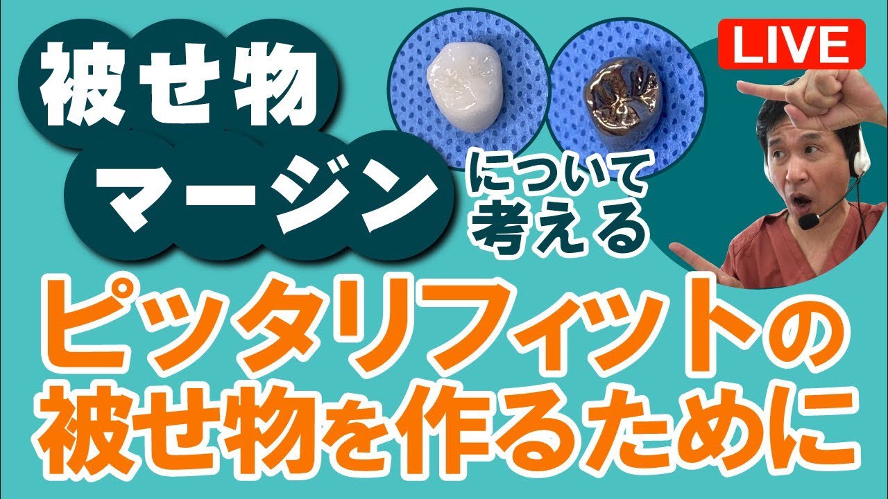 「被せ物のマージンについて考える！ピッタリフィットの被せ物を作るために」現役歯医者が解説