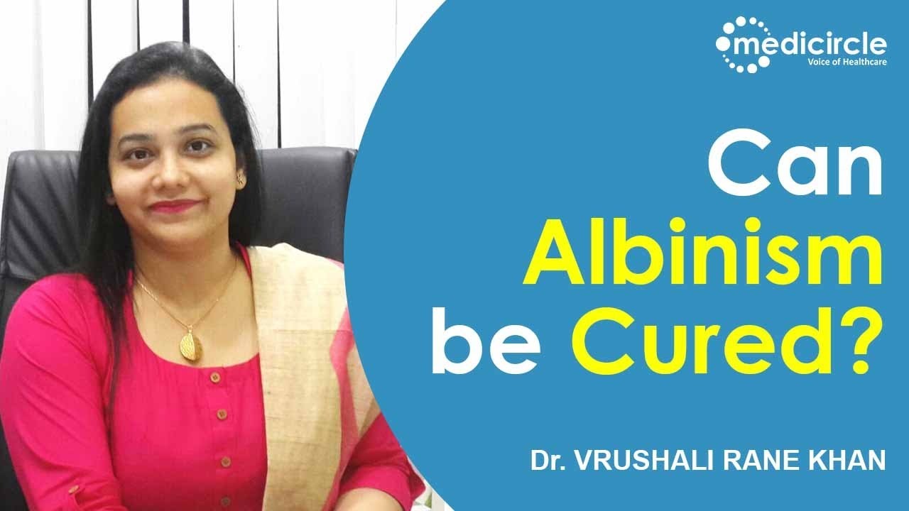 Can Albinism be cured? - Treatment for Albino Child | Dr. Vrushali Rane Khan