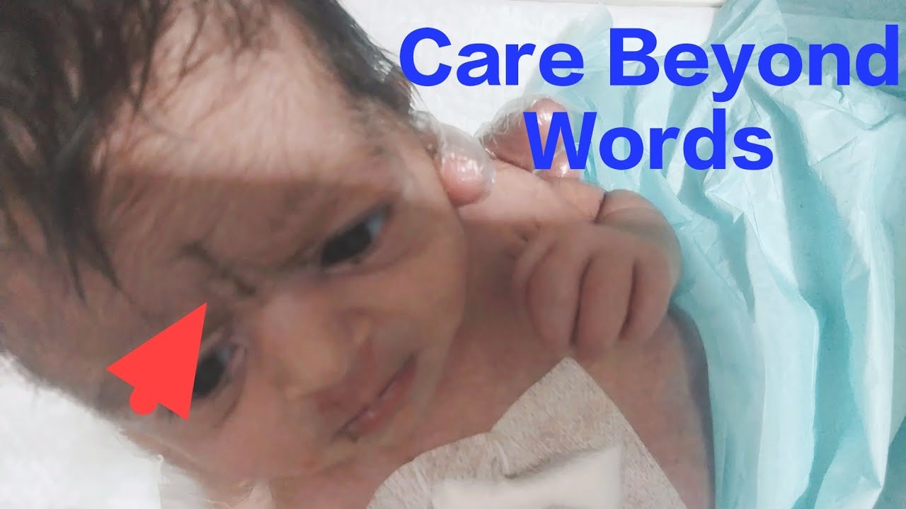 Removing Kohl Marking with Love | NICU Baby Care Moment