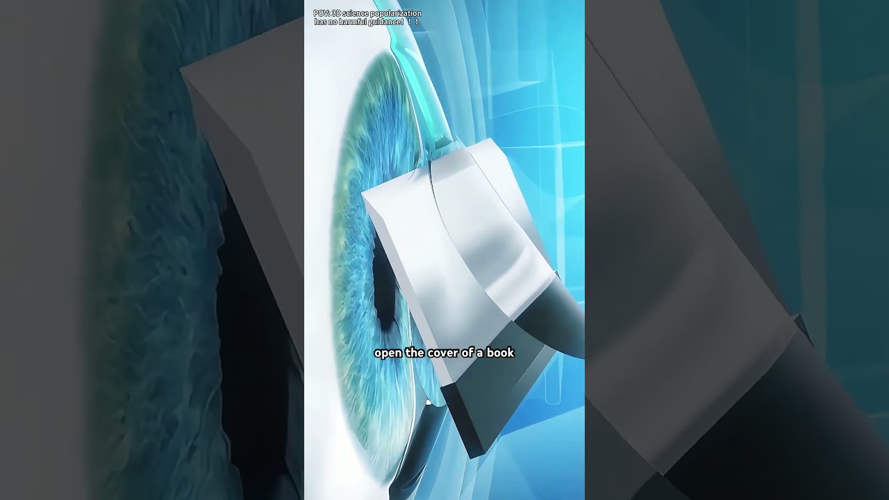 LASIK Eye Surgery (3D Animation)#lasereyesurgery #lasereyesurgeon #lasik #lasikeyesurgery #lasikeye
