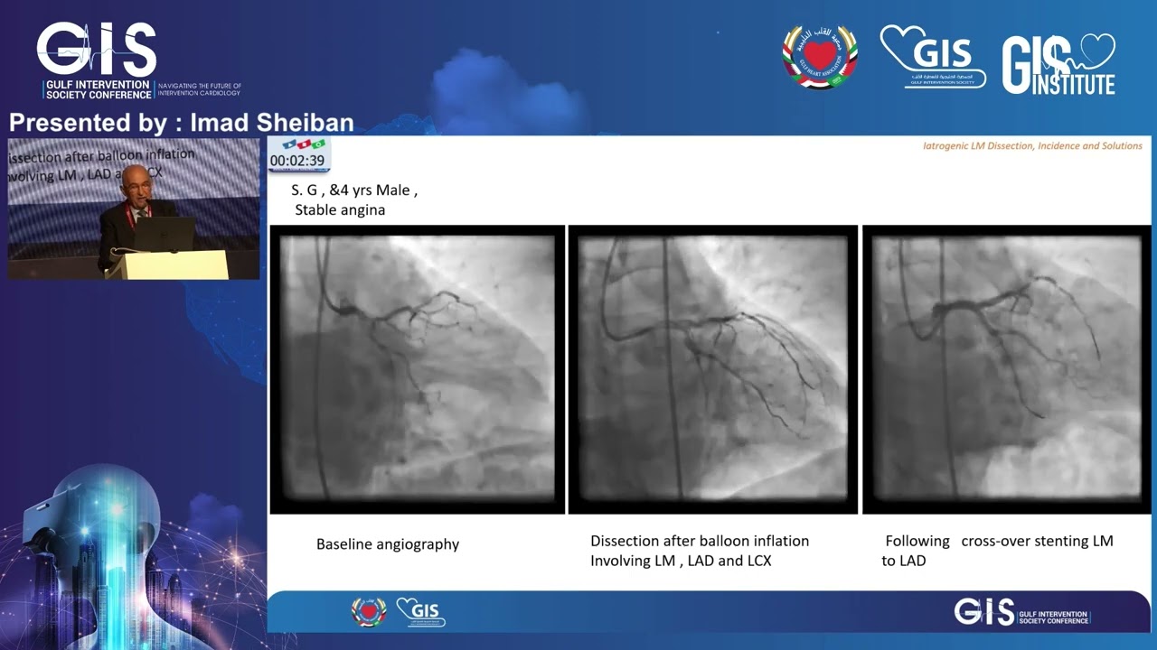 10  Imad Sheiban   Iatrogenic LM Dissection, Incidence and Solutions
