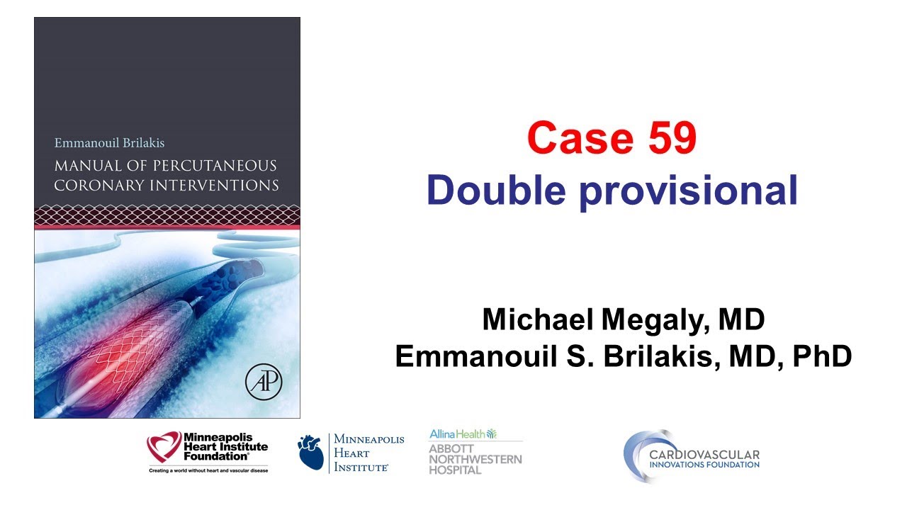 Case 59: PCI Manual - Double provisional