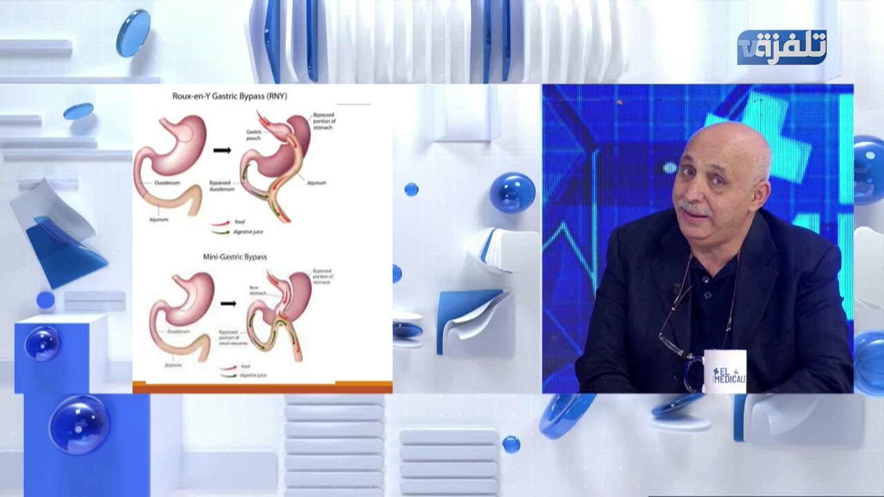 د.مراد عدالة :السمنة هو مشكل كبير في العالم و مرض خطير لكنه صامت