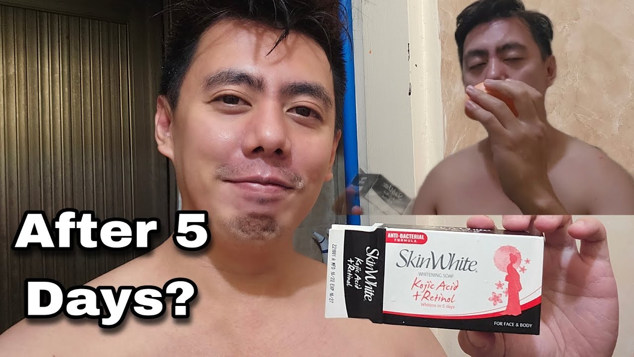 KOJIC ACID + RETINOL SOAP | Correct Tios & Demo by SkinWhite with Vitamin C, Niacinamide Review