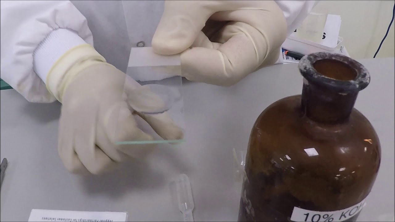 KOH technique for ectoparasites