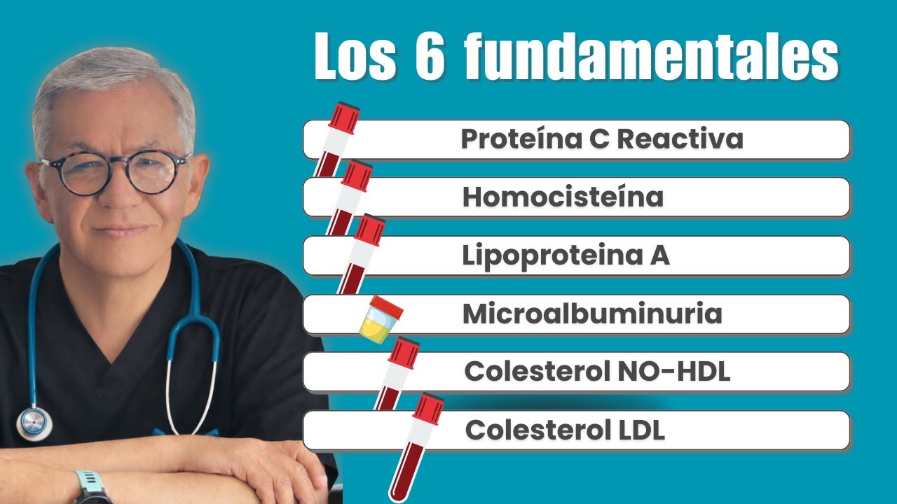 Si tienes más de 40, deberías conocerlos.
