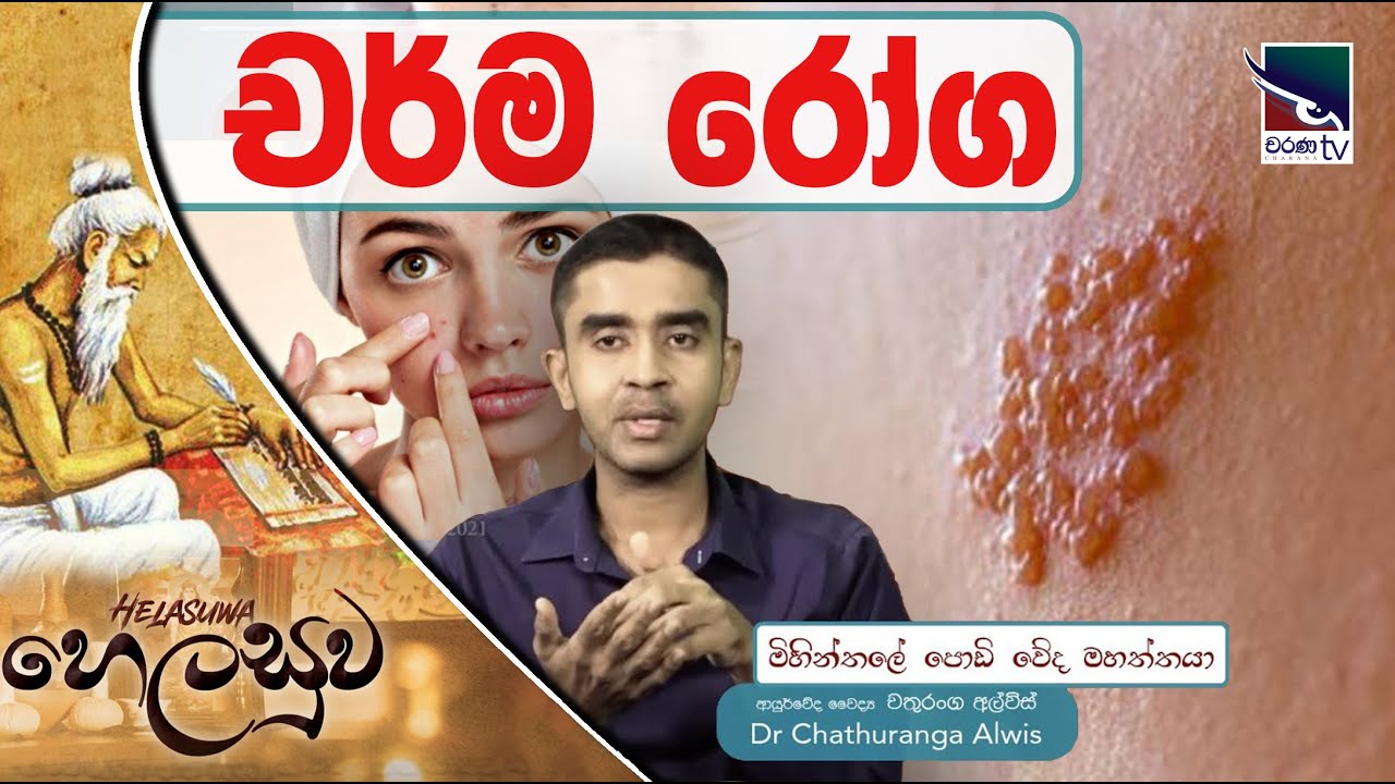 චර්ම රෝග හැදෙන්නේ ඇයි ? | Skin diseases