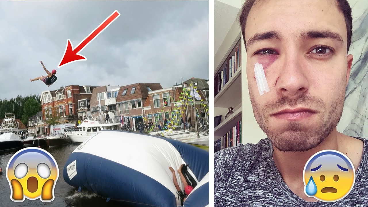 Filmstunt gaat mis | #Furtjuh