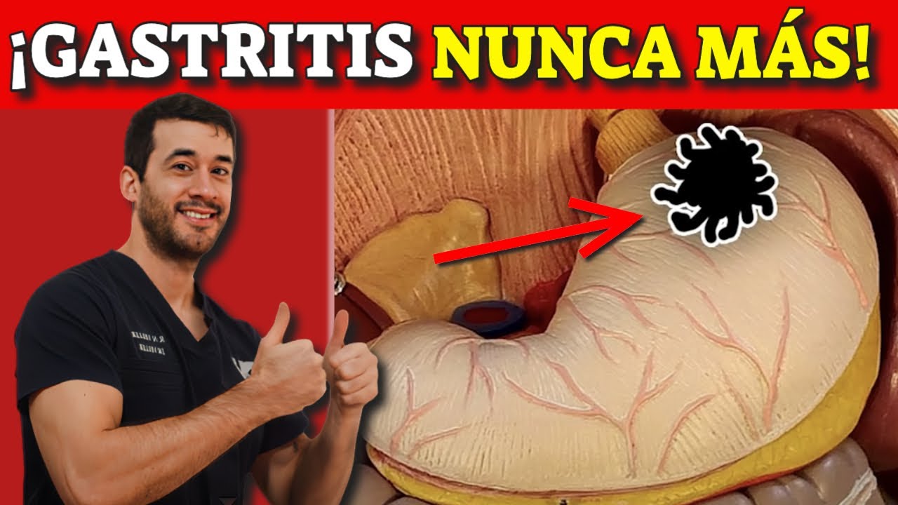 S&iacute;gnos y s&iacute;ntomas de alarma de gastritis y c&oacute;mo se cura (remedios naturales)