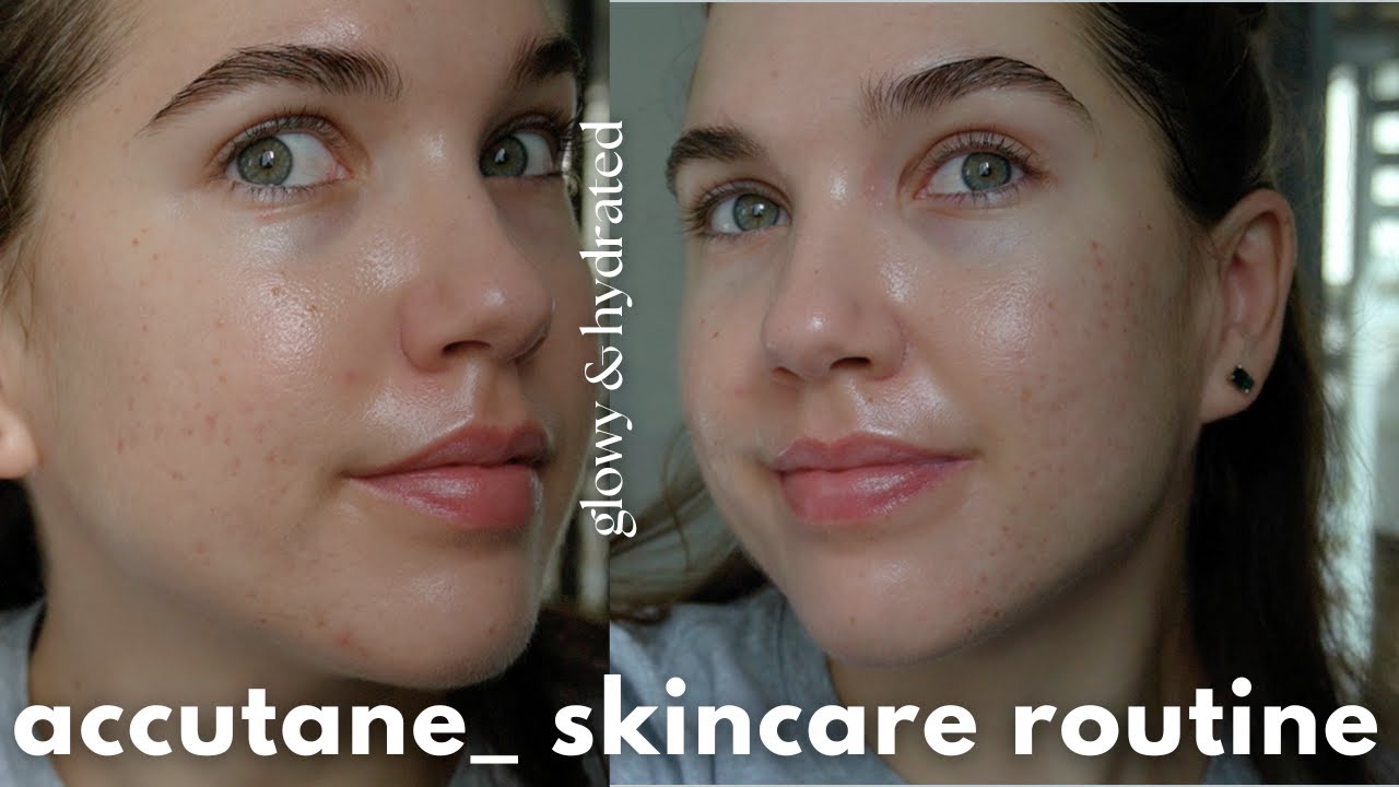 updated skincare routine *on accutane* | acne-prone, dry, sensitive skin
