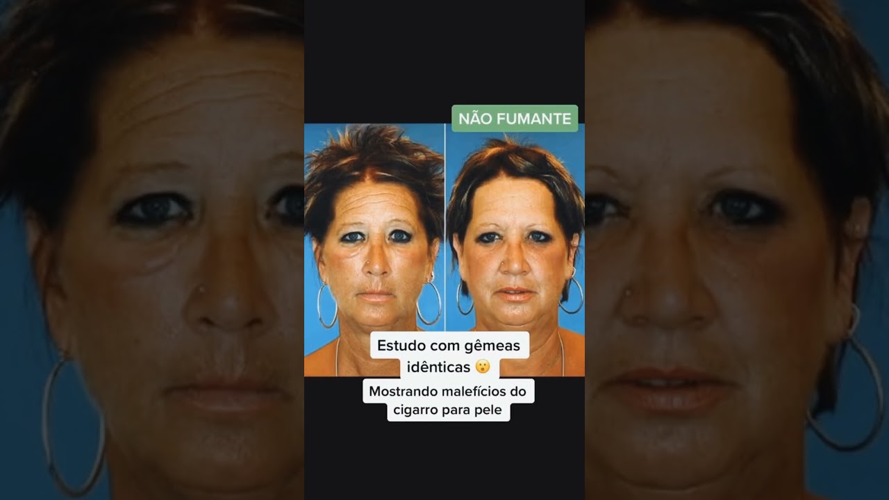 Olha &oacute; estrago que faz o cigarro para pele😰 #cuidadoscomapele #dicasdebeleza #pelesaudavel