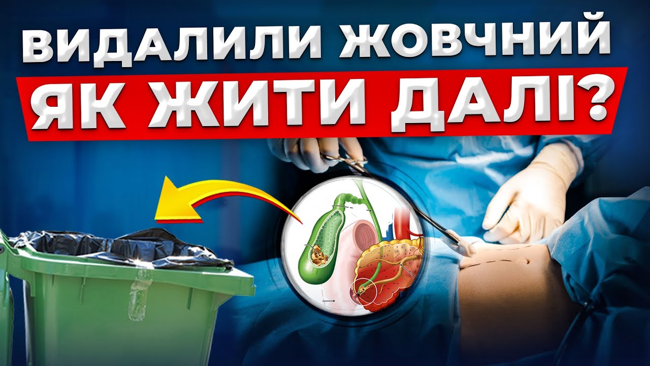 Алгоритм допомоги організму після видалення жовчного міхура. ТРИ головні ПРАВИЛА!