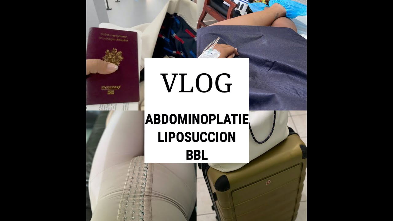 VLOG ABDOMINOPLASTIE LIPO BBL SAINT DOMINGUE
