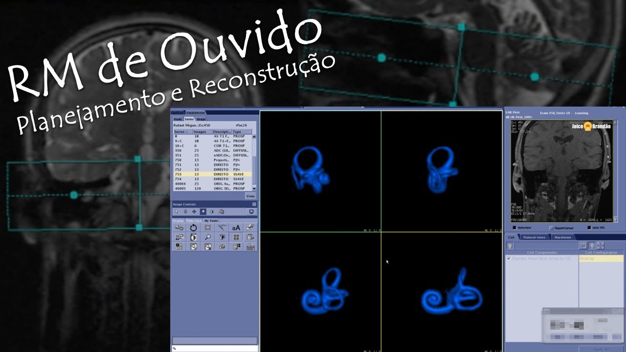 RM de Ouvido