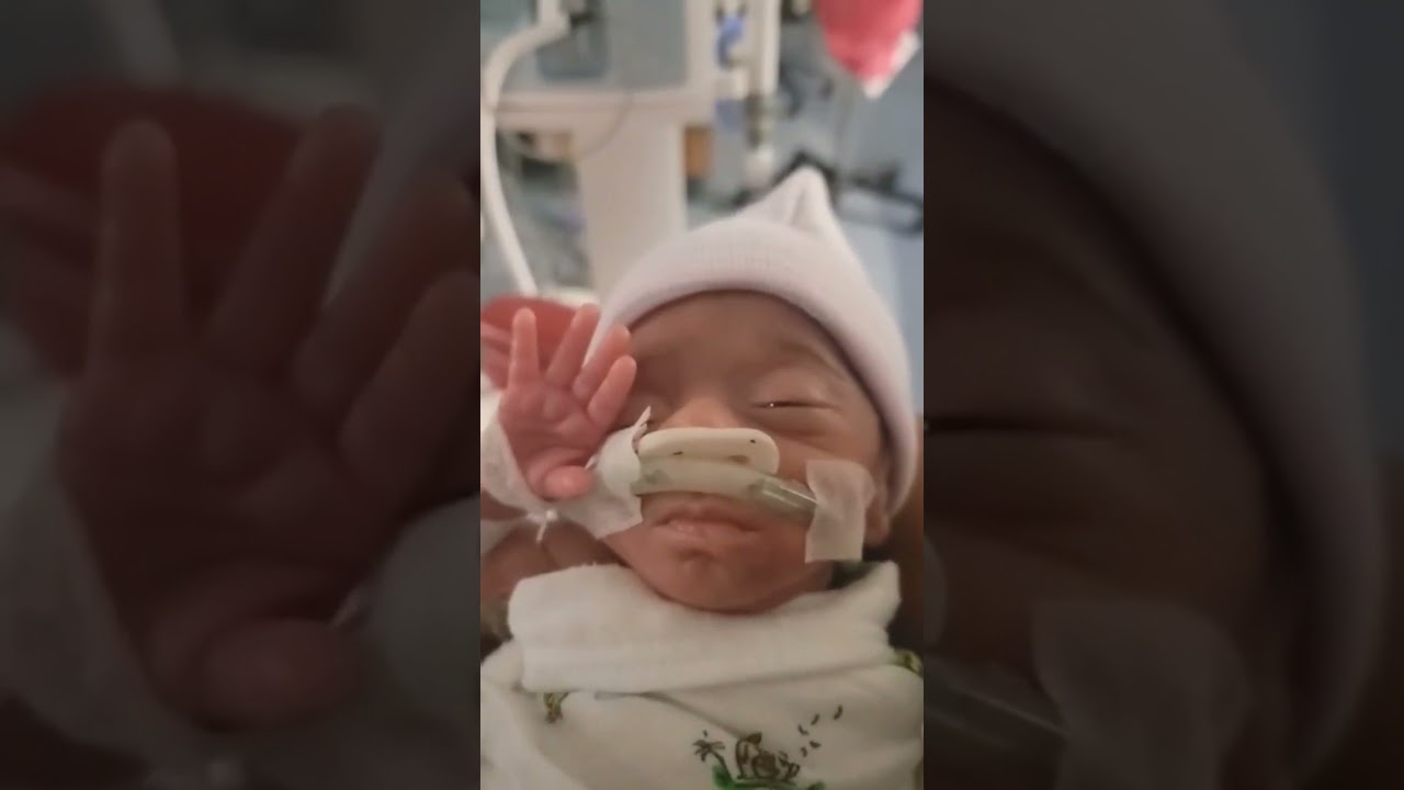 side eye #atlanta #micropreemie #ivfsuccessfirsttime #nicujourney