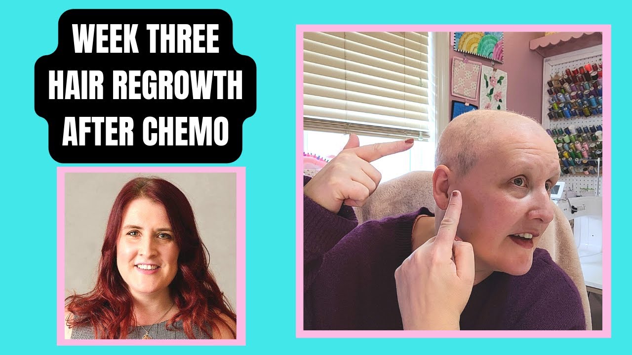 Hair Growth After Chemo: 3 Weeks Update : My Breast Cancer Stage 2a Journey