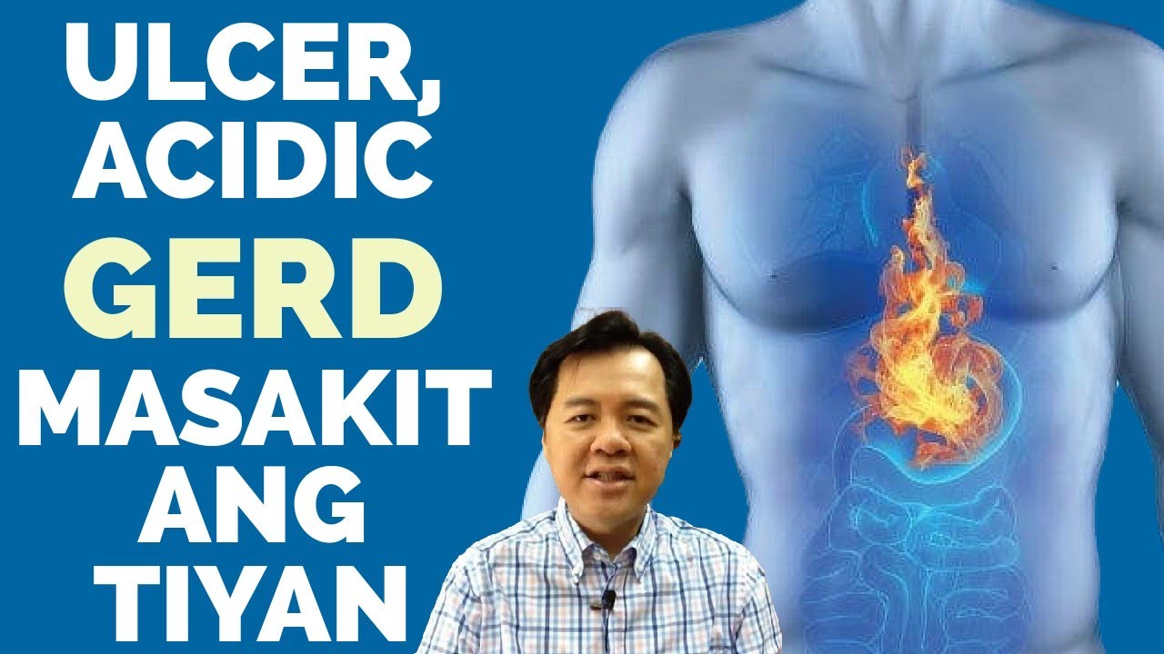Ulcer, Acidic, GERD at Masakit ang Tiyan - Payo ni Doc Willie Ong #