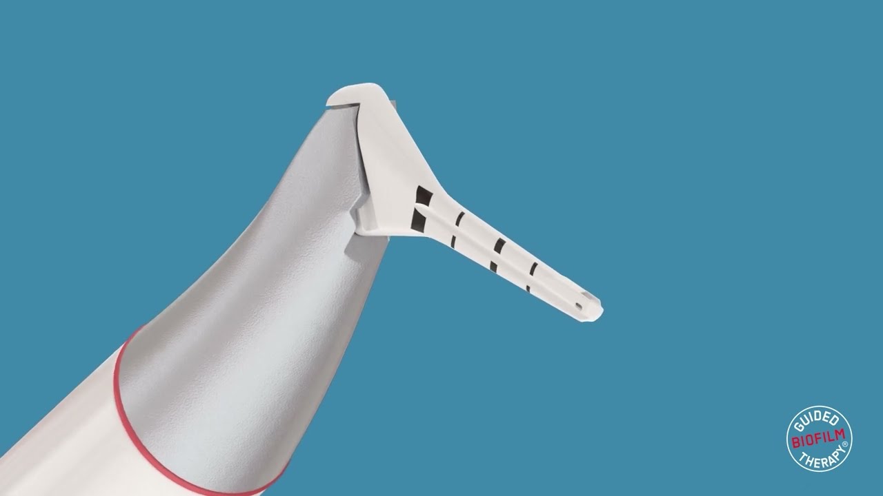 PERIOFLOW® allows effective removal of biofilm down to the deepest periodontal pockets
