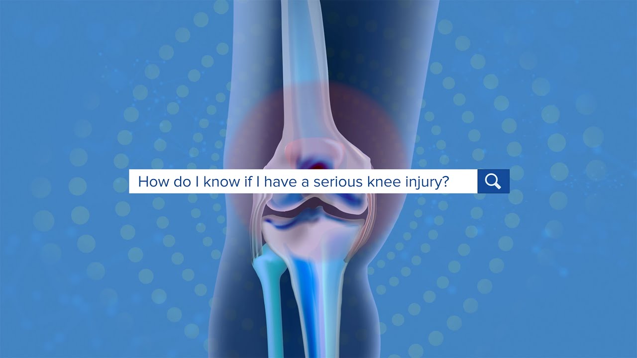 How Do I Know If I Have A Serious Knee Injury?