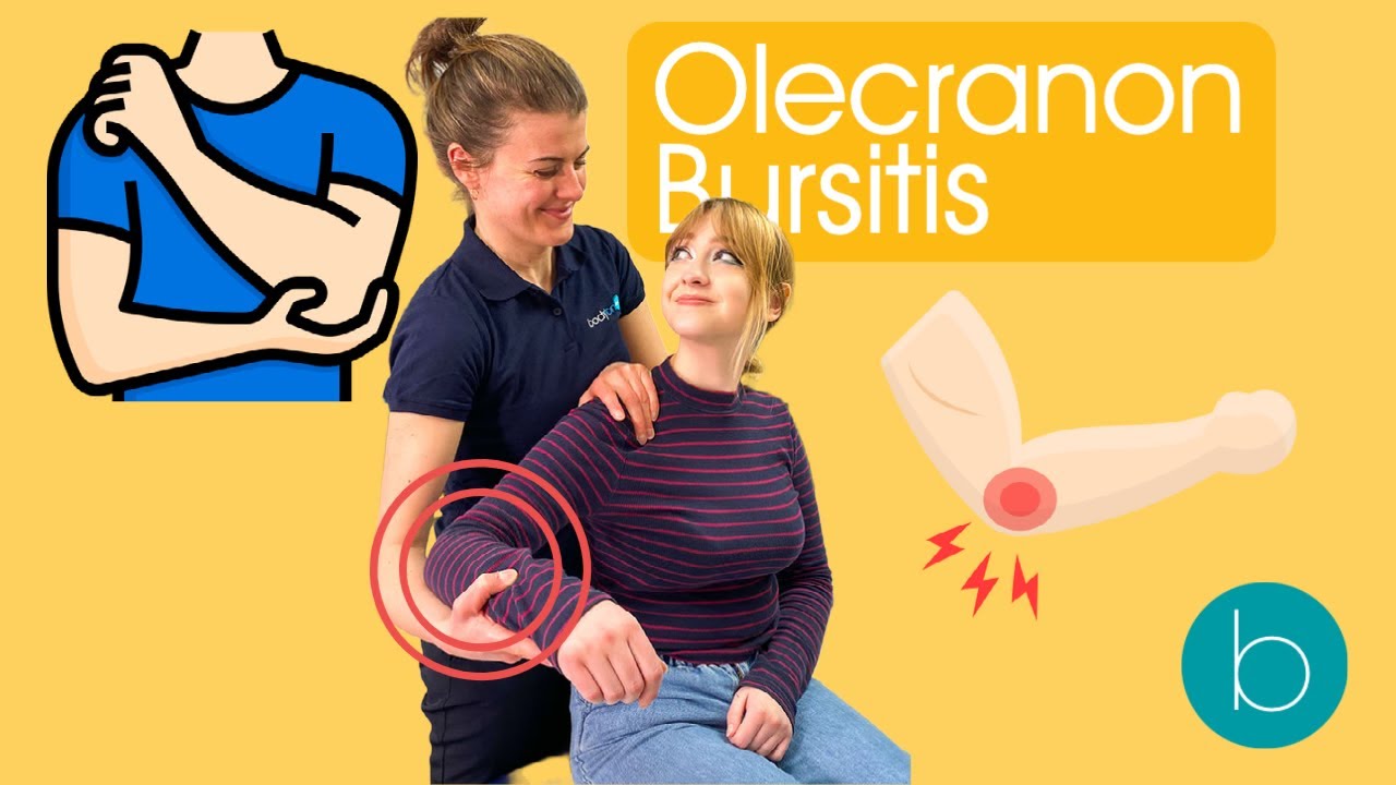 Olecranon Bursitis
