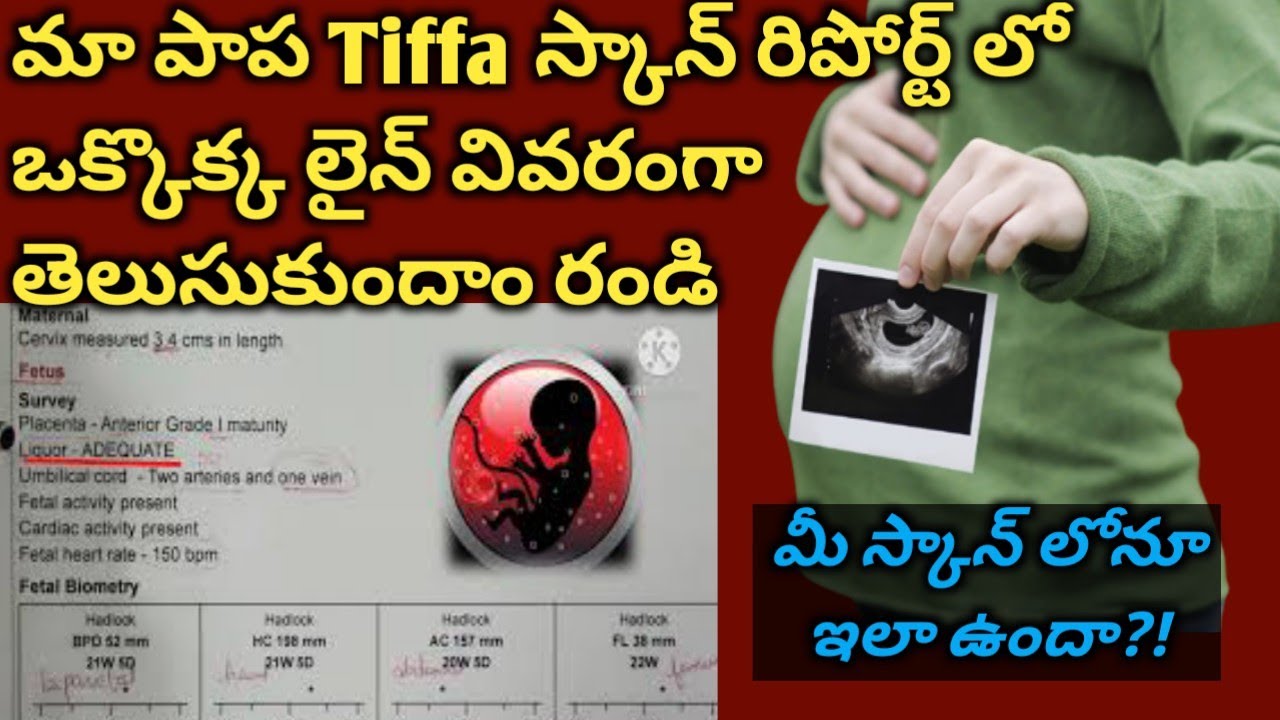 How to Read Tiffa Scan Report full details | Baby Girl Scan report | Pregnancy | Mom Geetha's Tips
