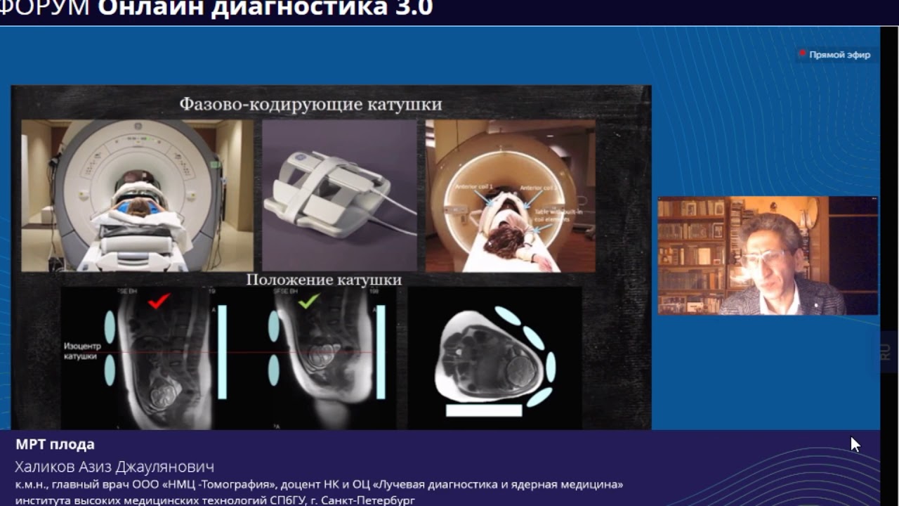 МРТ плода и плаценты