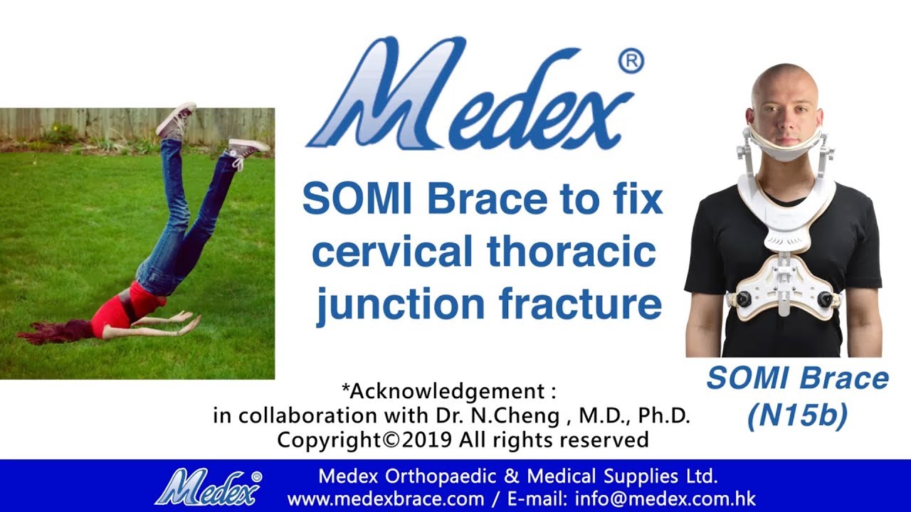N15b - SOMI Brace to fix cervical thoracic junction fracture  (3D Animation)