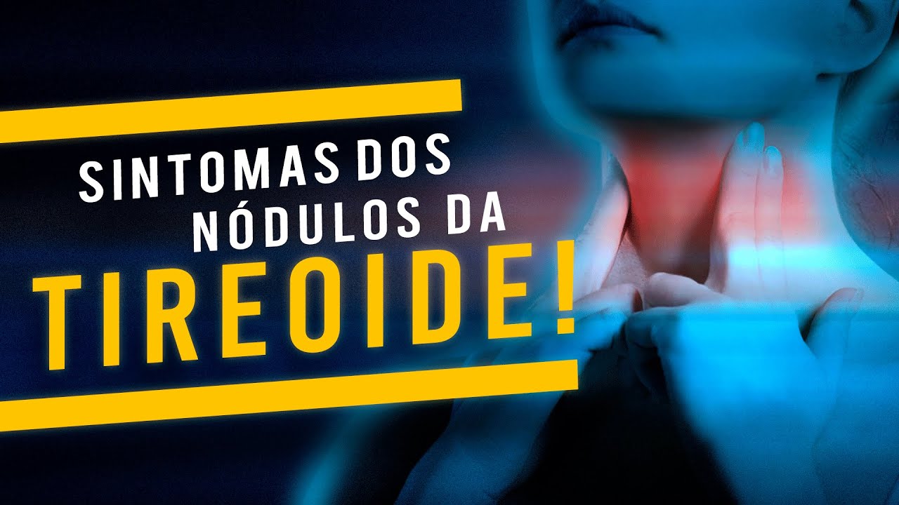 Sintomas dos n&oacute;dulos de tireoide [Dr. Rog&eacute;rio Leite]