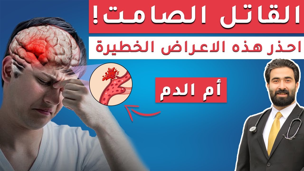 أم الدم :القاتل الصامت | أعراض تمدد الأوعية الدموية وكيف تحمي نفسك | أفضل العادات لتجنب النزيف