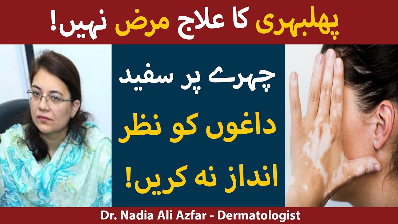 Chehre Par Safed Daag Ka Ilaj Aur Ye Kyu Hote Hai | Phulbehri Ka Ilaj | Vitiligo Treatment In Urdu