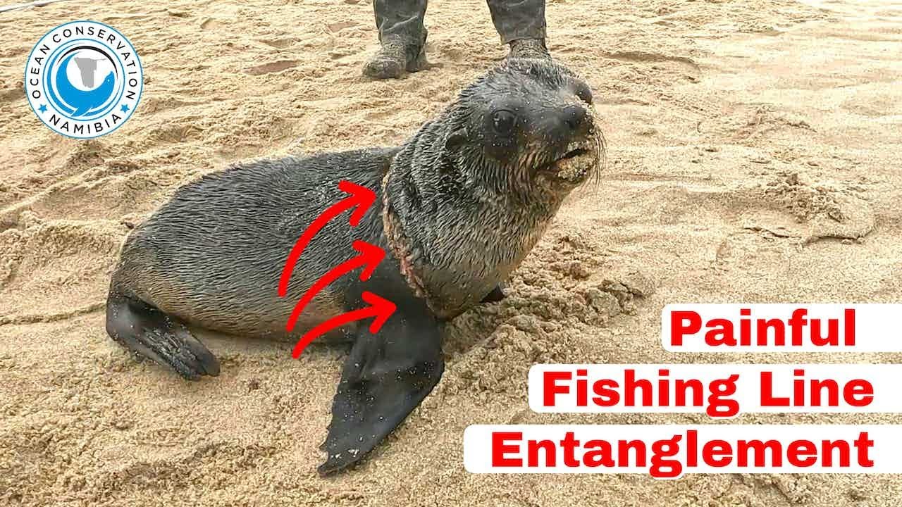 Painful Fishing Line Entanglement