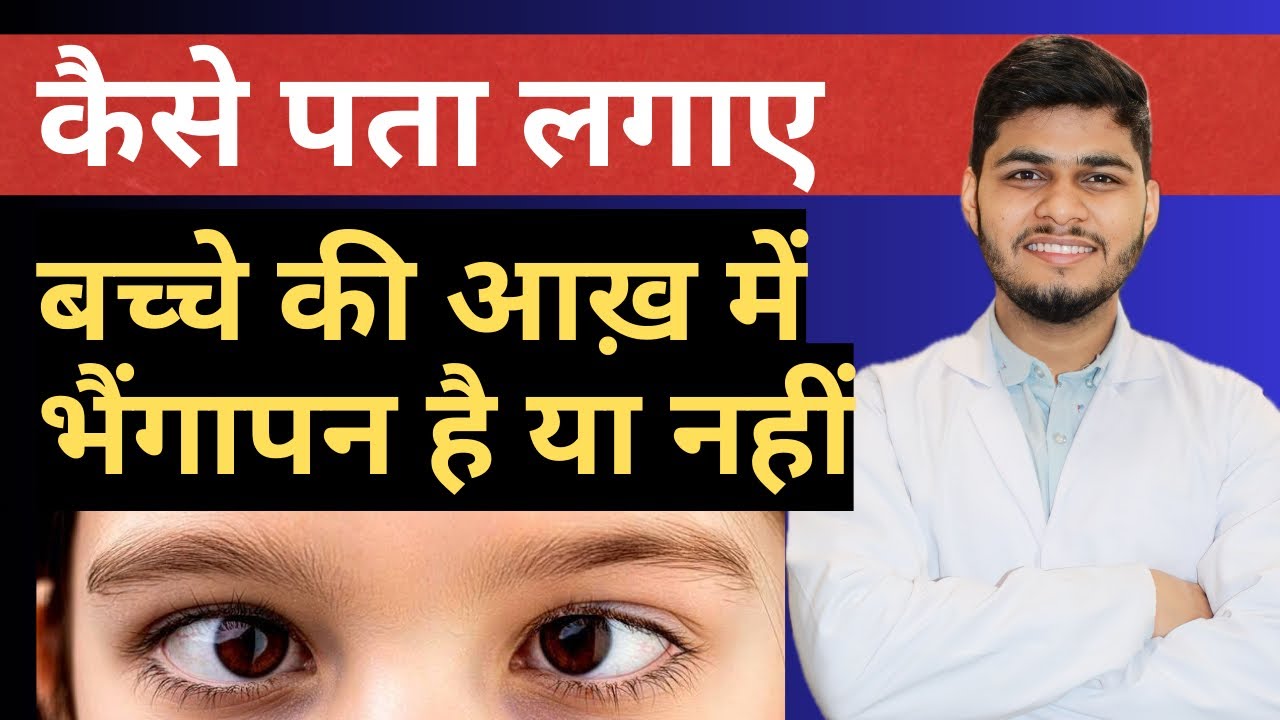 How to Check Squint At Home | Best exercise For Squint Eye | Strabismus