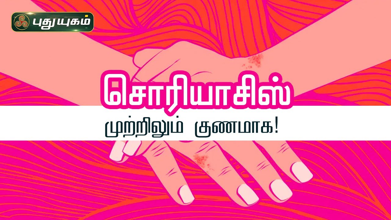 சொரியாசிஸ் (Psoriasis) முற்றிலும் குணமாக! Dr. N.R. Jayakumar | PuthuyugamTV