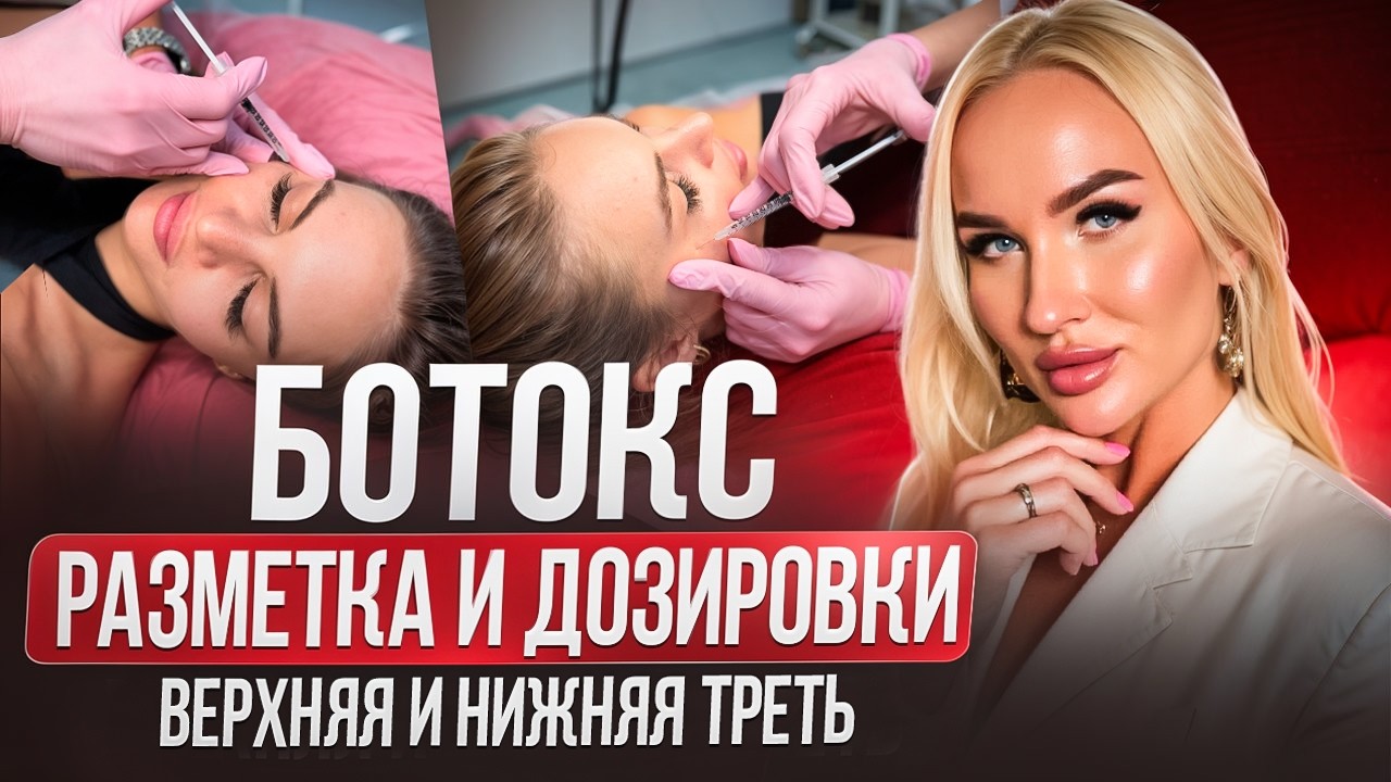 Ботокс. Разметка и дозировки. Верхняя и нижняя треть